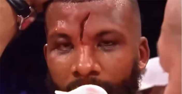 Badou Jack sufrió un fuerte corte.